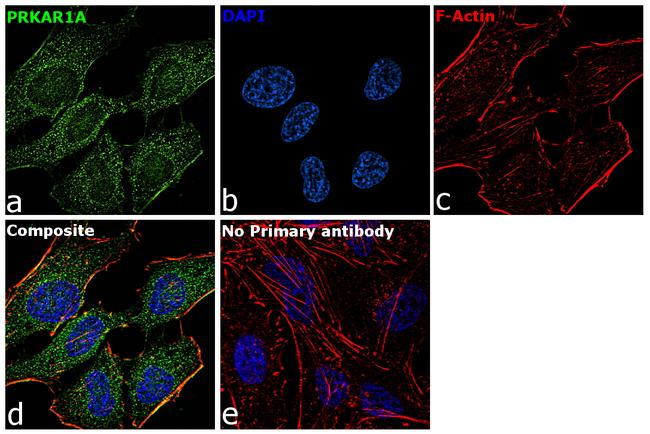 PRKAR1A Antibody in Immunocytochemistry (ICC/IF)