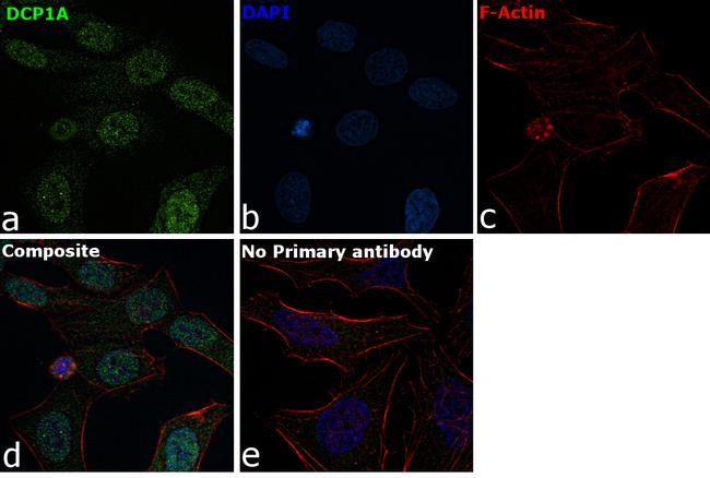 DCP1A Antibody in Immunocytochemistry (ICC/IF)