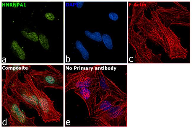 hnRNP A1 Antibody in Immunocytochemistry (ICC/IF)