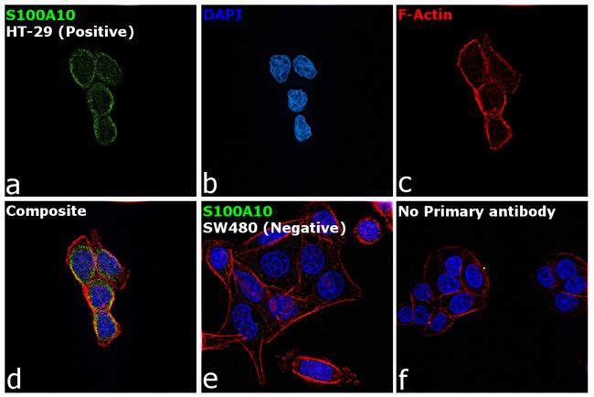 S100A10 Antibody in Immunocytochemistry (ICC/IF)