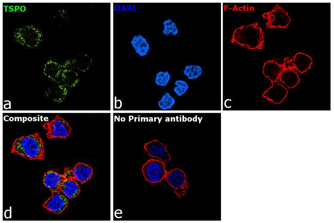 TSPO Antibody in Immunocytochemistry (ICC/IF)