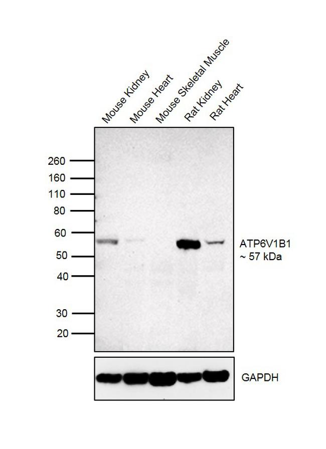 ATP6V1B1 Antibody in Western Blot (WB)