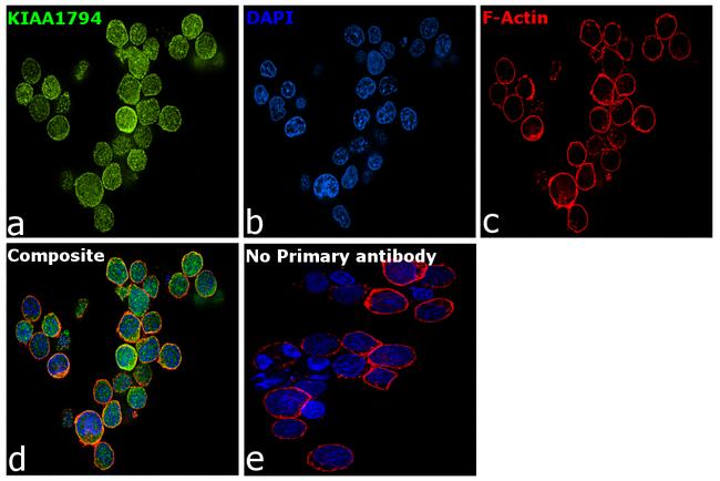 FANCI Antibody in Immunocytochemistry (ICC/IF)