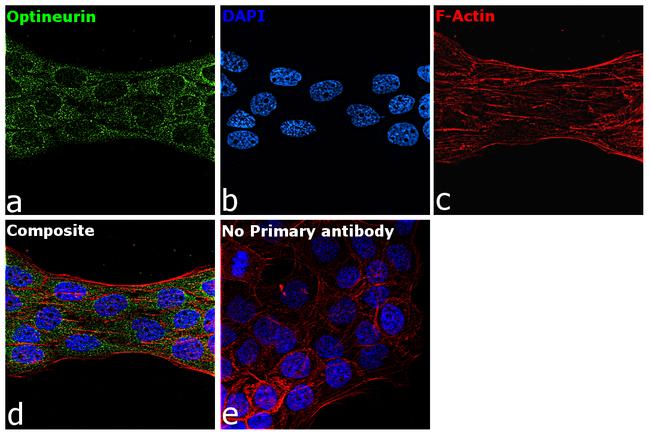 Optineurin Antibody in Immunocytochemistry (ICC/IF)