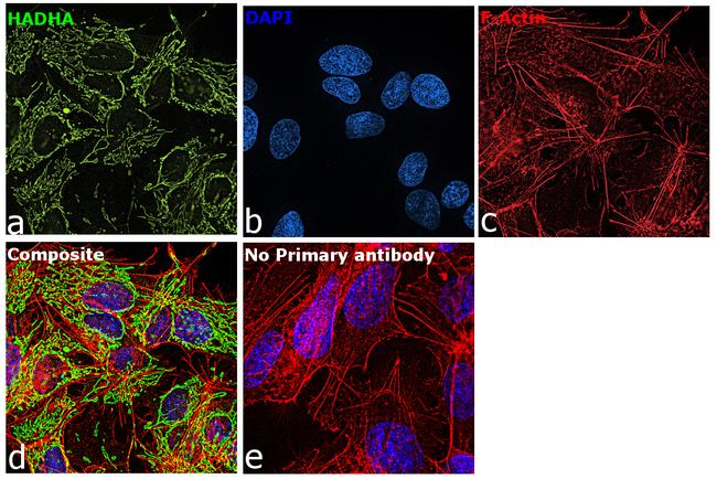 HADHA Antibody in Immunocytochemistry (ICC/IF)