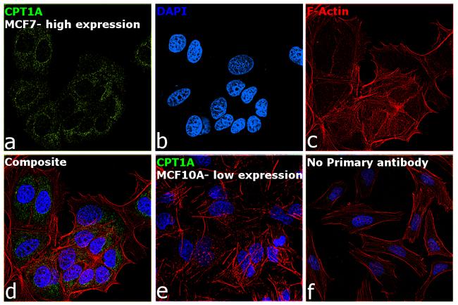 CPT1A Antibody in Immunocytochemistry (ICC/IF)