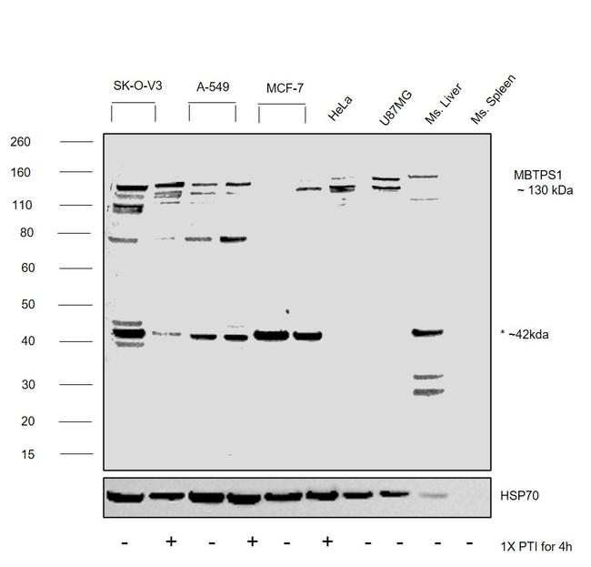 MBTPS1 Antibody in Western Blot (WB)