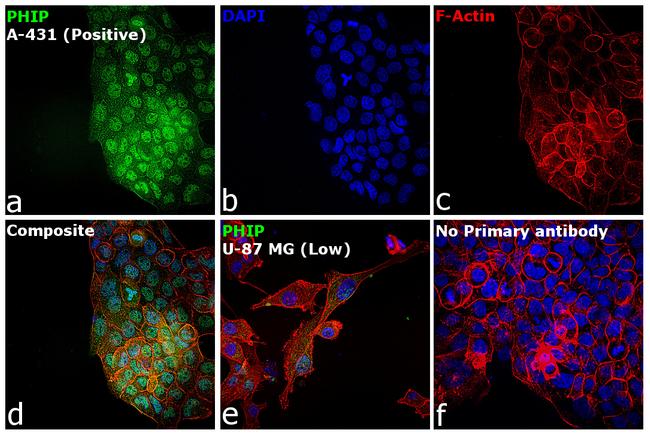 PHIP Antibody in Immunocytochemistry (ICC/IF)