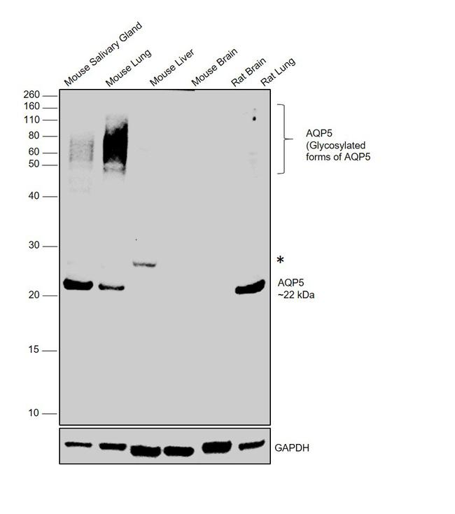 Aquaporin 5 Antibody in Western Blot (WB)