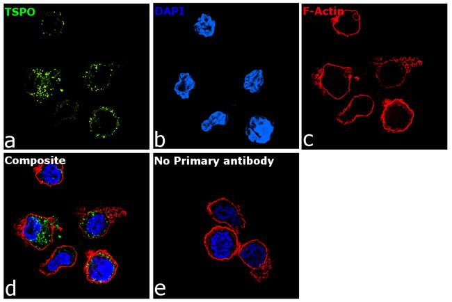 TSPO Antibody in Immunocytochemistry (ICC/IF)