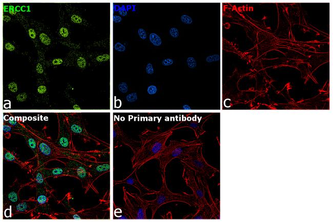 ERCC1 Antibody in Immunocytochemistry (ICC/IF)