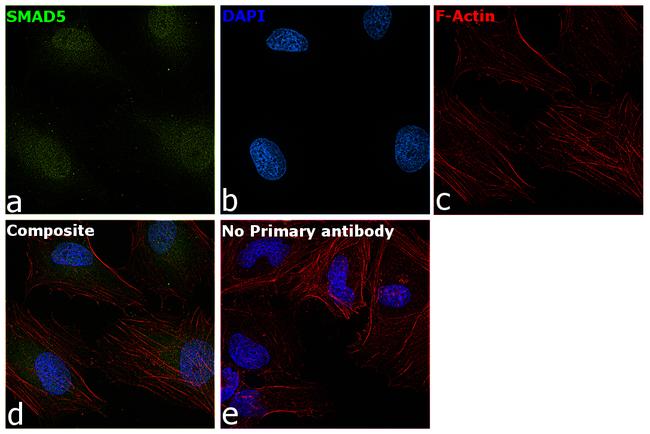 SMAD5 Antibody in Immunocytochemistry (ICC/IF)