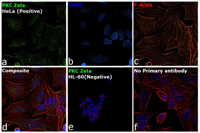 PKC zeta Antibody in Immunocytochemistry (ICC/IF)