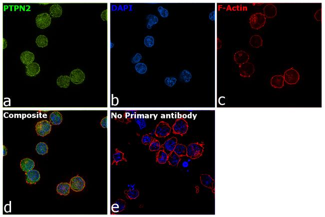 PTPN2 Antibody in Immunocytochemistry (ICC/IF)