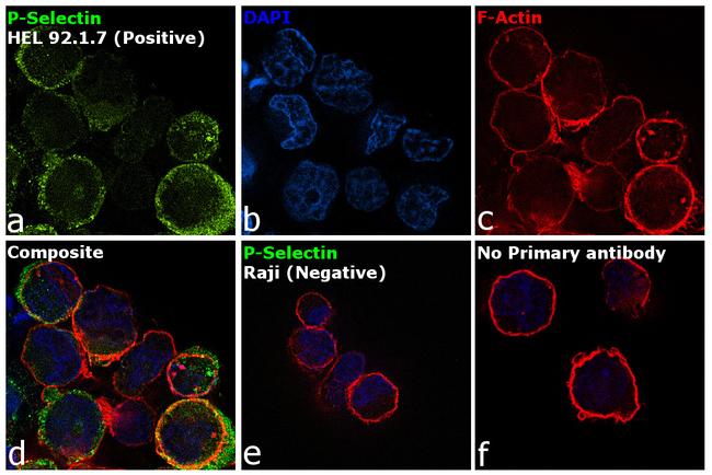 P-Selectin Antibody in Immunocytochemistry (ICC/IF)