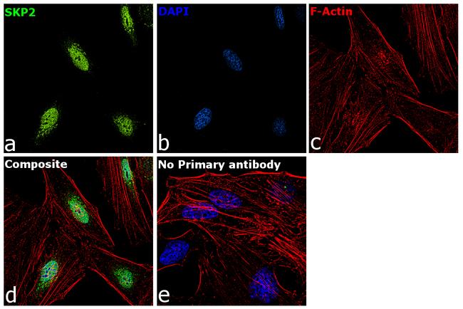 SKP2 Antibody in Immunocytochemistry (ICC/IF)