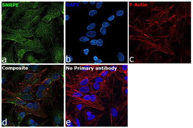 SNRPE Antibody in Immunocytochemistry (ICC/IF)