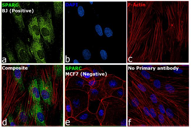 SPARC Antibody in Immunocytochemistry (ICC/IF)