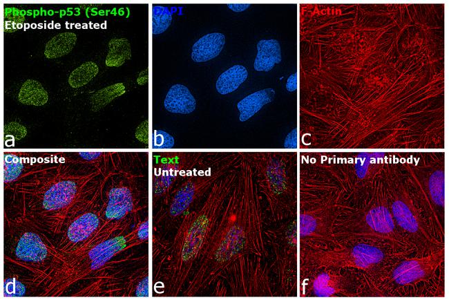 Phospho-p53 (Ser46) Antibody in Immunocytochemistry (ICC/IF)