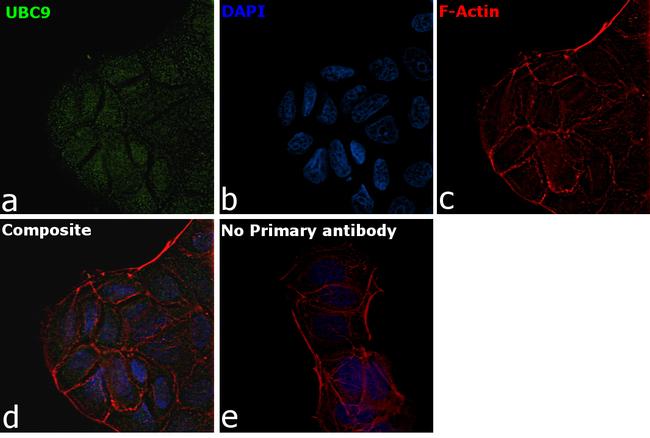 UBC9 Antibody in Immunocytochemistry (ICC/IF)