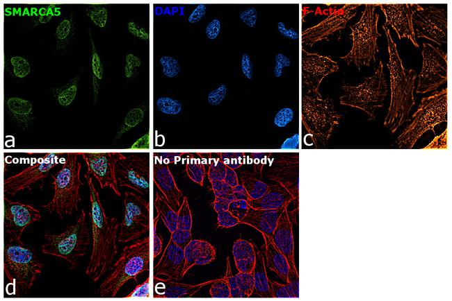 SMARCA5 Antibody in Immunocytochemistry (ICC/IF)