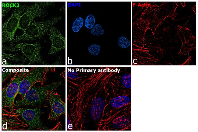 ROCK2 Antibody in Immunocytochemistry (ICC/IF)