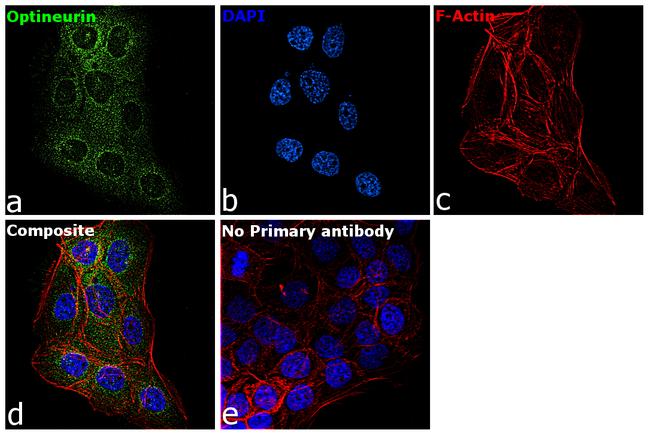 Optineurin Antibody in Immunocytochemistry (ICC/IF)