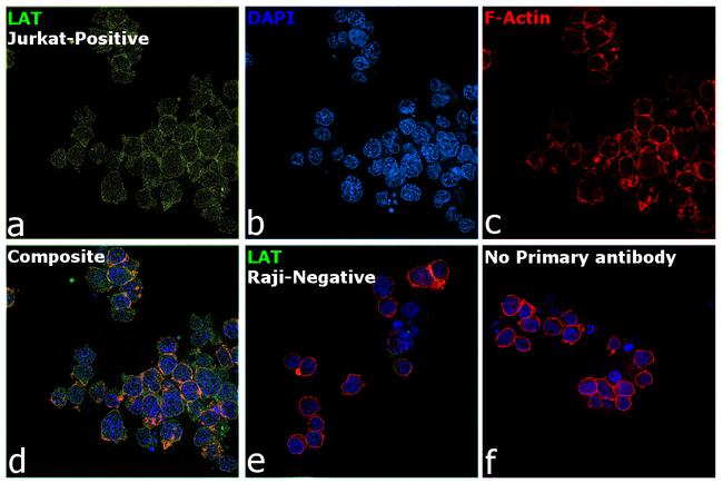 LAT Antibody in Immunocytochemistry (ICC/IF)