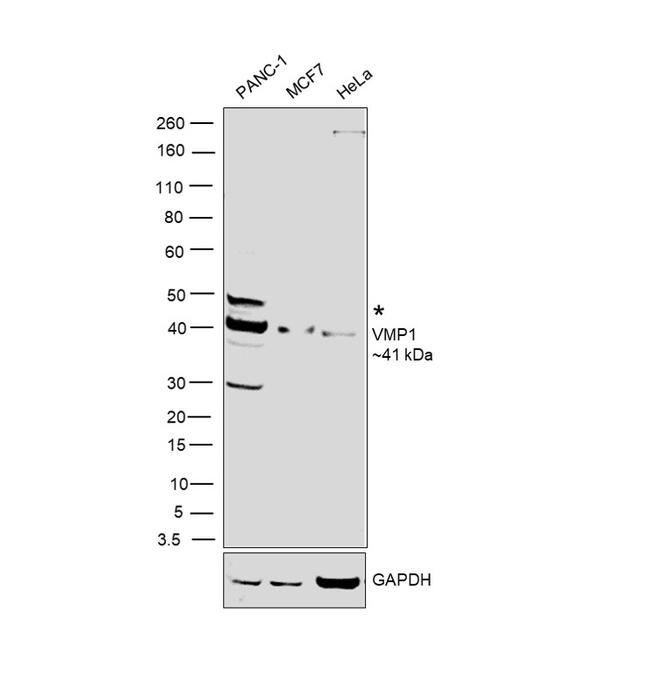 VMP1 Antibody in Western Blot (WB)