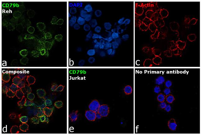 CD79b Antibody in Immunocytochemistry (ICC/IF)