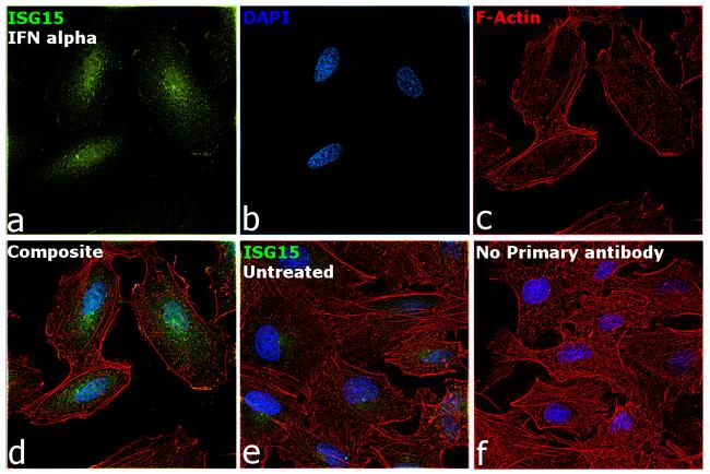 ISG15 Antibody in Immunocytochemistry (ICC/IF)