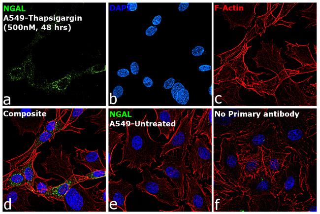 NGAL Antibody in Immunocytochemistry (ICC/IF)