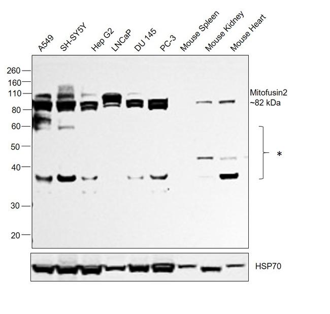 MFN2 Antibody in Western Blot (WB)