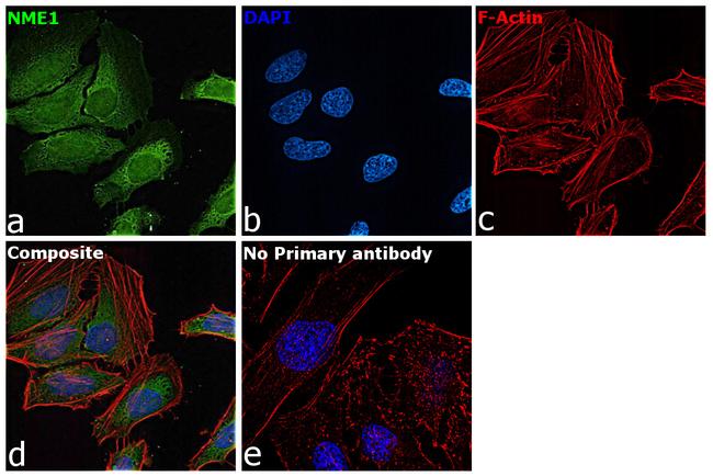 NME1 Antibody in Immunocytochemistry (ICC/IF)