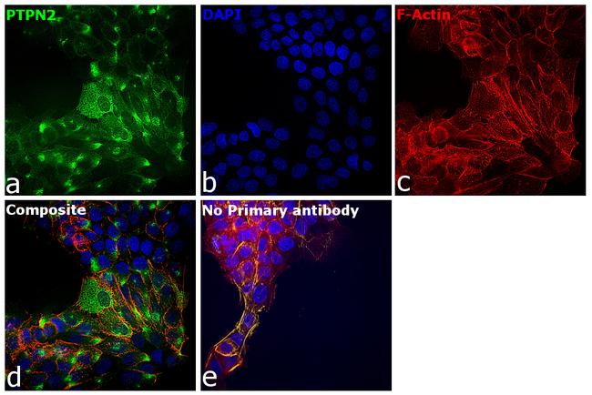 PTPN2 Antibody in Immunocytochemistry (ICC/IF)