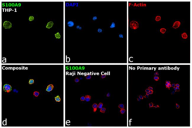 S100A9 Antibody in Immunocytochemistry (ICC/IF)