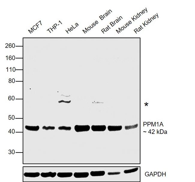 PPM1A Antibody in Western Blot (WB)