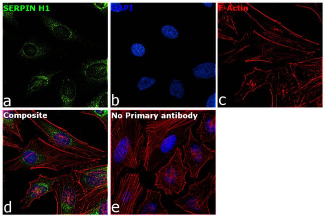 SERPINH1 Antibody in Immunocytochemistry (ICC/IF)