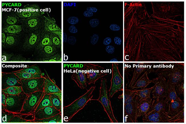 PYCARD Antibody in Immunocytochemistry (ICC/IF)