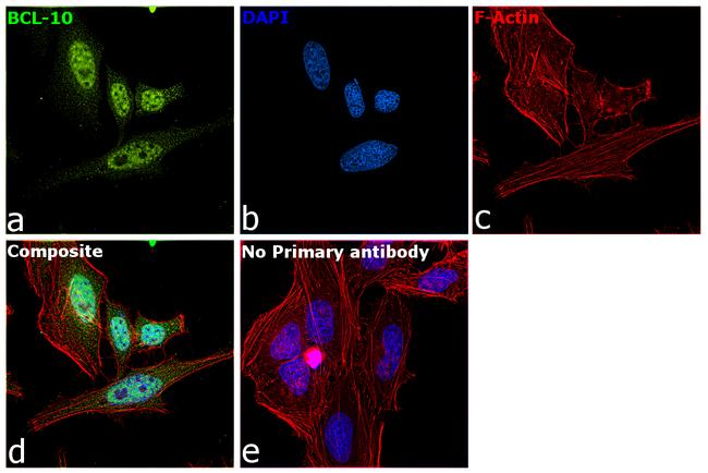 Bcl-10 Antibody in Immunocytochemistry (ICC/IF)