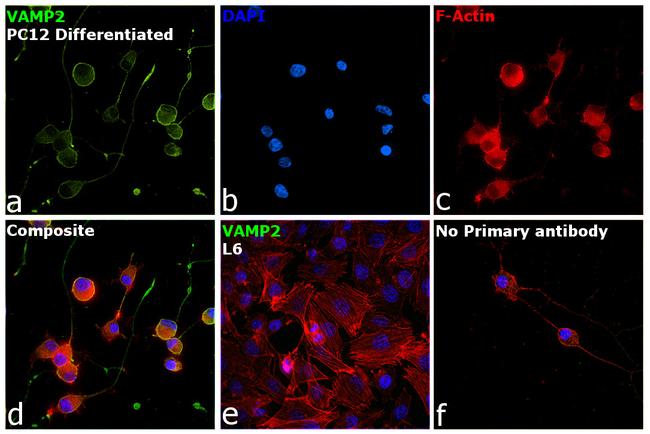 VAMP2 Antibody in Immunocytochemistry (ICC/IF)