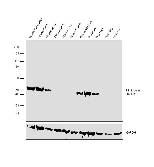 Beta III Tubulin Antibody in Western Blot (WB)