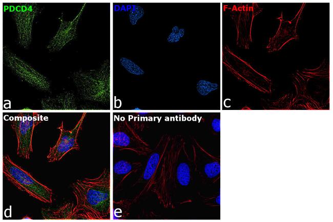 PDCD4 Antibody in Immunocytochemistry (ICC/IF)