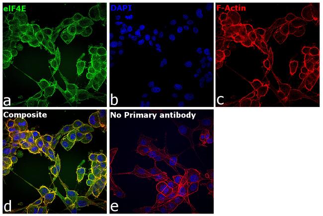 eIF4E Antibody in Immunocytochemistry (ICC/IF)