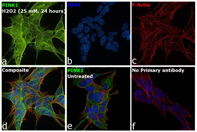 PINK1 Antibody in Immunocytochemistry (ICC/IF)