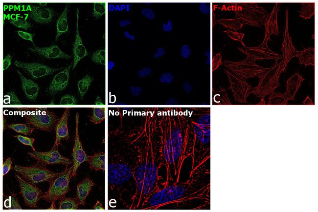 PPM1A Antibody in Immunocytochemistry (ICC/IF)