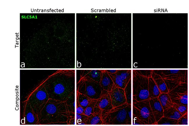 SGLT1 Antibody in Immunocytochemistry (ICC/IF)