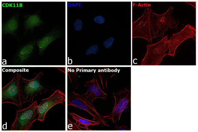 CDK11B Antibody in Immunocytochemistry (ICC/IF)