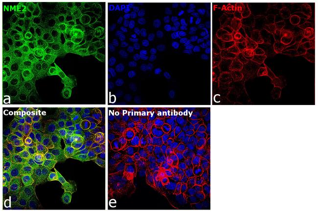 NME1/NME2 Antibody in Immunocytochemistry (ICC/IF)