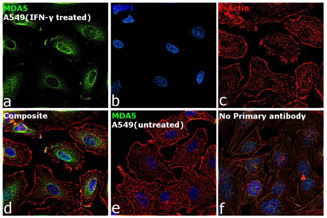 MDA5 Antibody in Immunocytochemistry (ICC/IF)